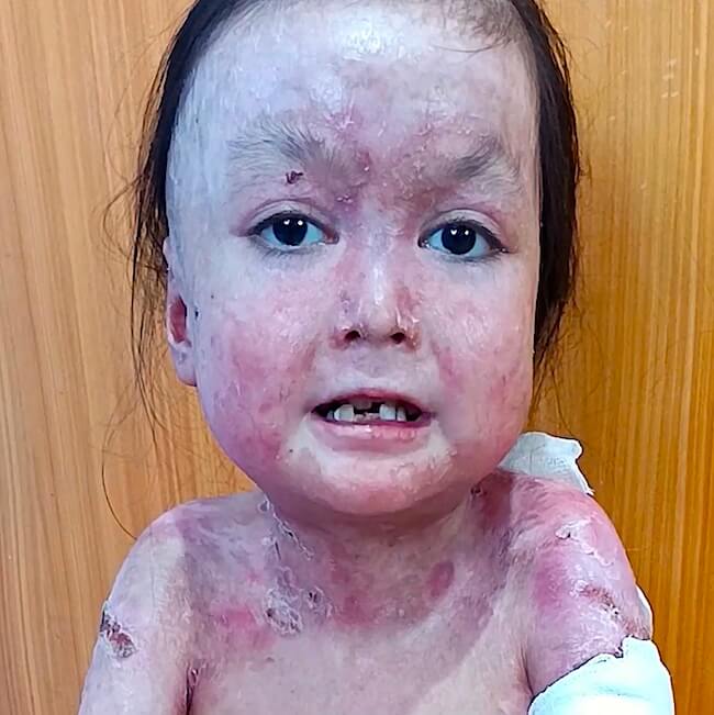 Shamila needs urgent treatment